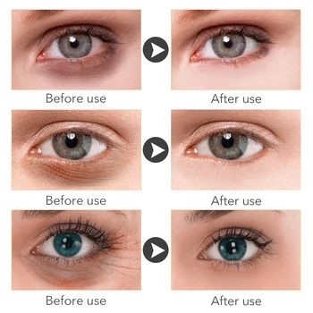EFERO 60pcs Kolagénová Očná Maska Očné Škvrny Podložky na Tvár Proti Vráskam Vyživujú A Hydratujú Odstrániť Tmavé Kruhy Vrásky 9455
