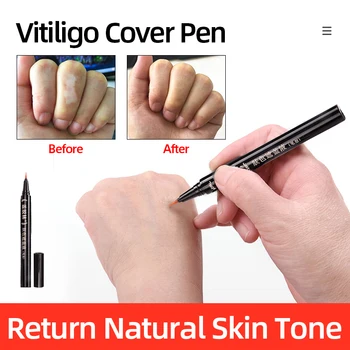 Vitiligo Jazvy Birthmarks Kryt Pero Nepremokavé dlhodobé Prirodzené Biele Škvrny Kamufláž make-up Pero Ženy, Mužov, Starostlivosť o Telo Pomocou