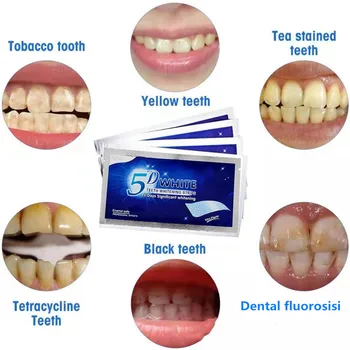 5D Gél Zuby Bieliace Pásiky Biele Zubov Zubné súpravy, Ústna Hygiena, Starostlivosť o Pás pre falošné Zuby Dyhy Zubár seks Bielenie gél