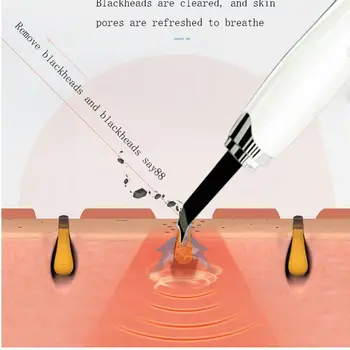 Oveliness Ultrazvukové Pokožky Práčky Pórov Čistič Na Tvár Peeling Čistiaci Stroj Lopatu Blackhead Odstraňovač Tváre Masér Starostlivosti Nástroj